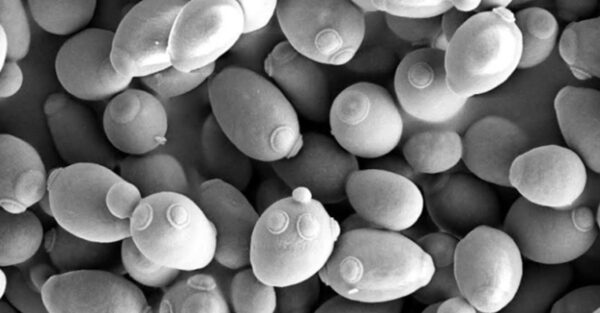 Not all yeasts are equal: what makes <em>Saccharomyces cerevisiae</em> var. <em>boulardii</em> so unique?